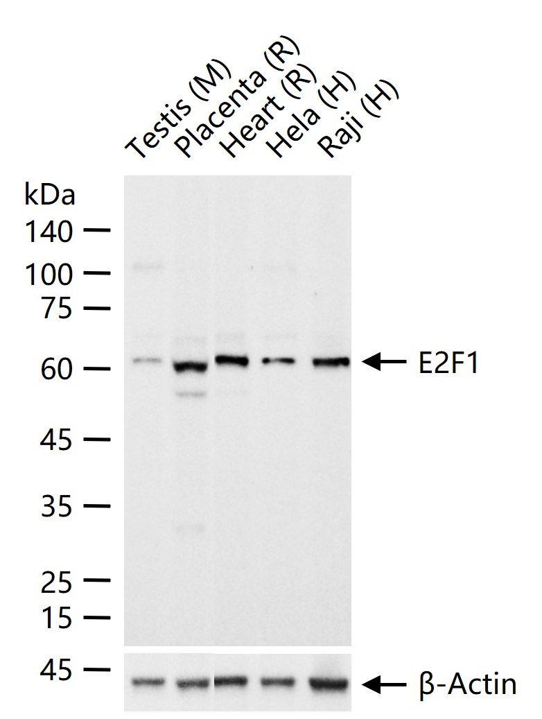 转录因子E2F-1重组兔单抗-bsm-61369R