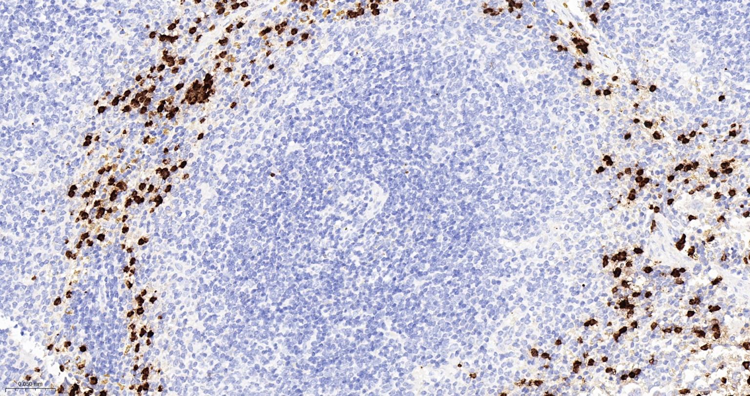 S100钙结合蛋白A8重组兔单抗-bsm-61167R