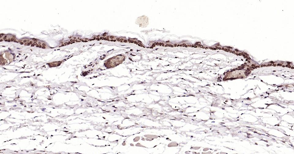 转录因子E2F-1重组兔单抗-bsm-61369R
