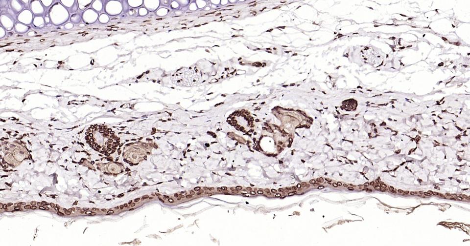 转录因子E2F-1重组兔单抗-bsm-61369R