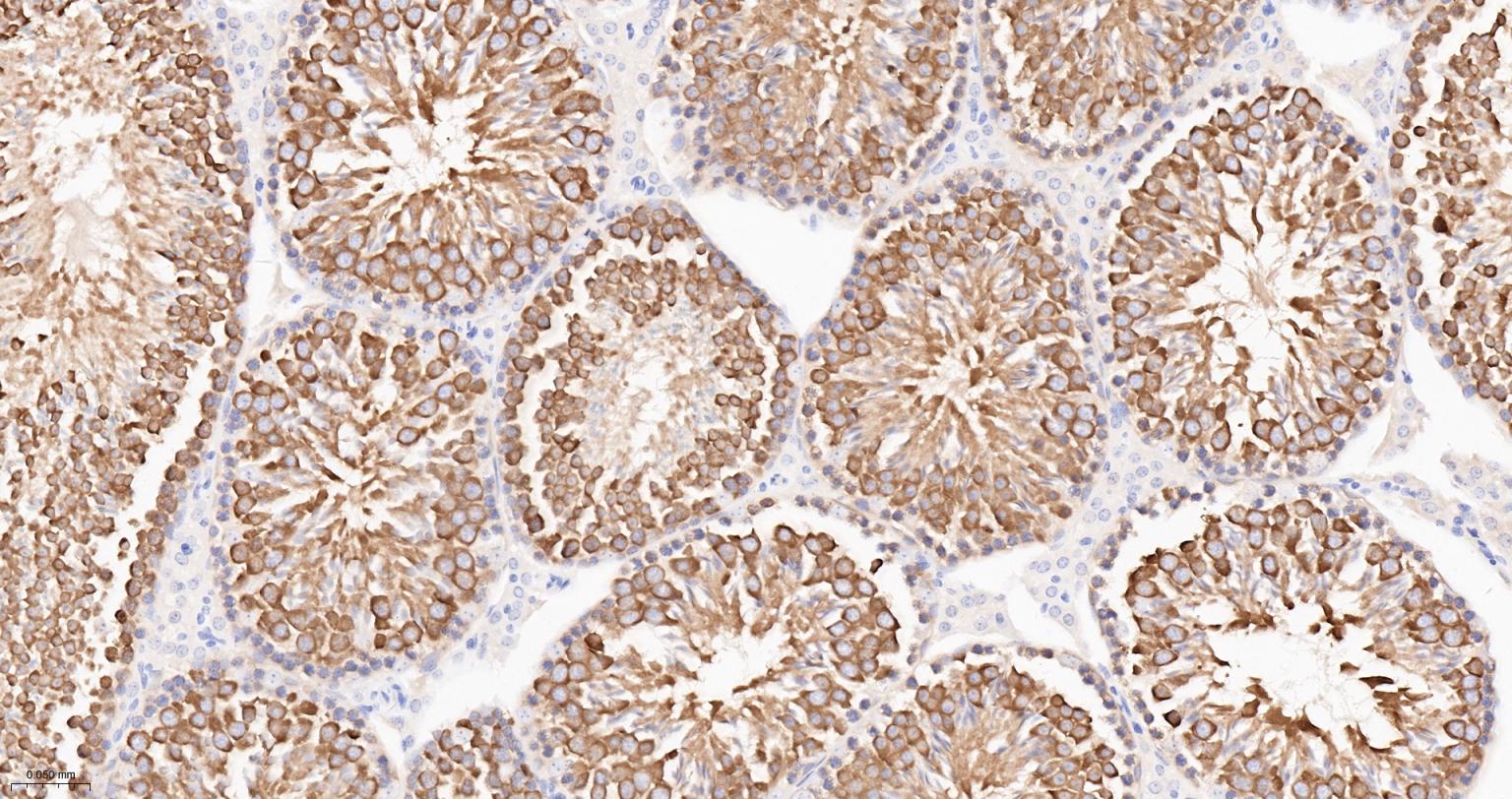 热休克蛋白90α重组兔单抗-bsm-52353R