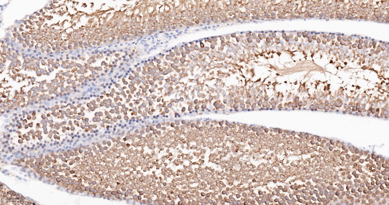 热休克蛋白90α重组兔单抗-bsm-52353R