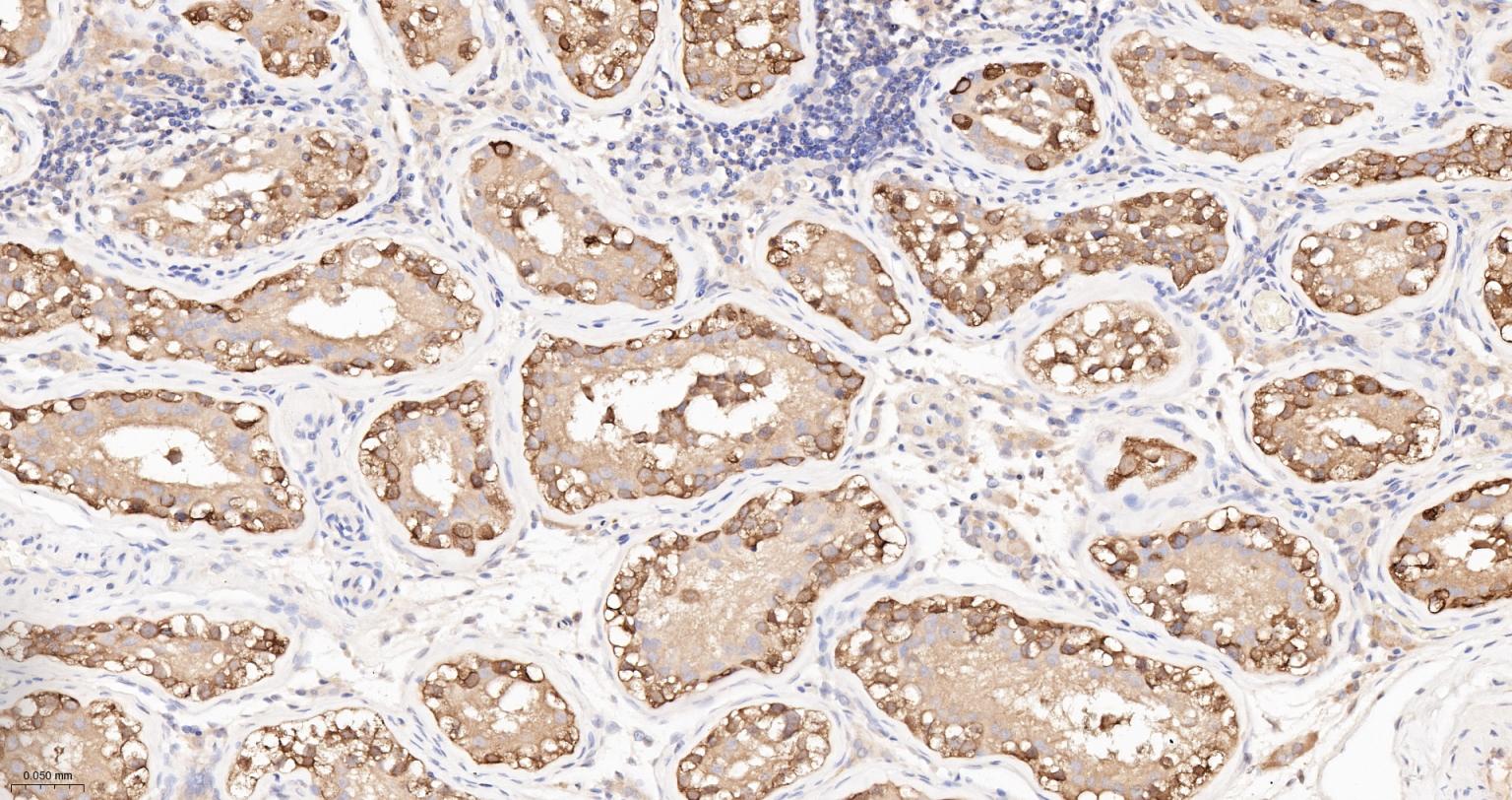 热休克蛋白90α重组兔单抗-bsm-52353R