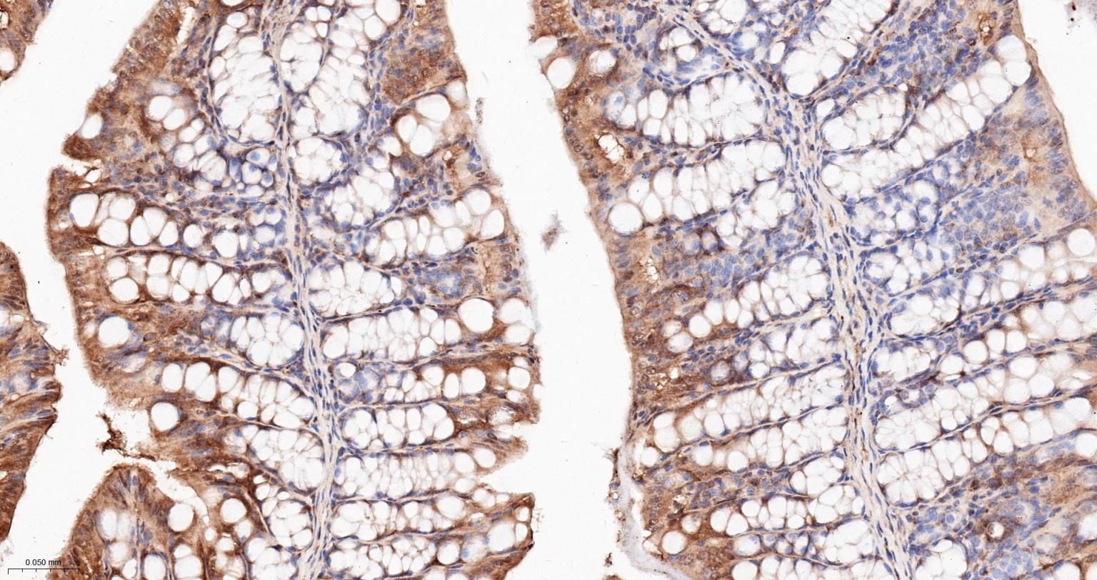 热休克蛋白90α重组兔单抗-bsm-52353R