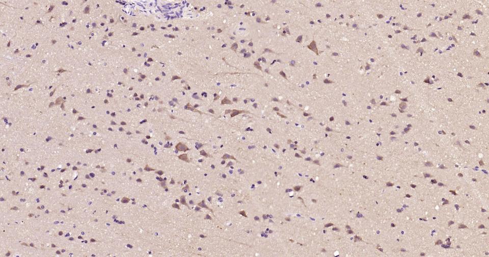 热休克蛋白90α重组兔单抗-bsm-52353R