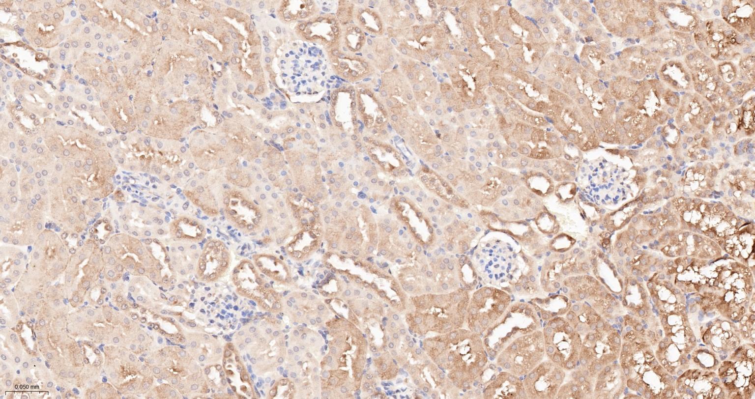 热休克蛋白90α重组兔单抗-bsm-52353R