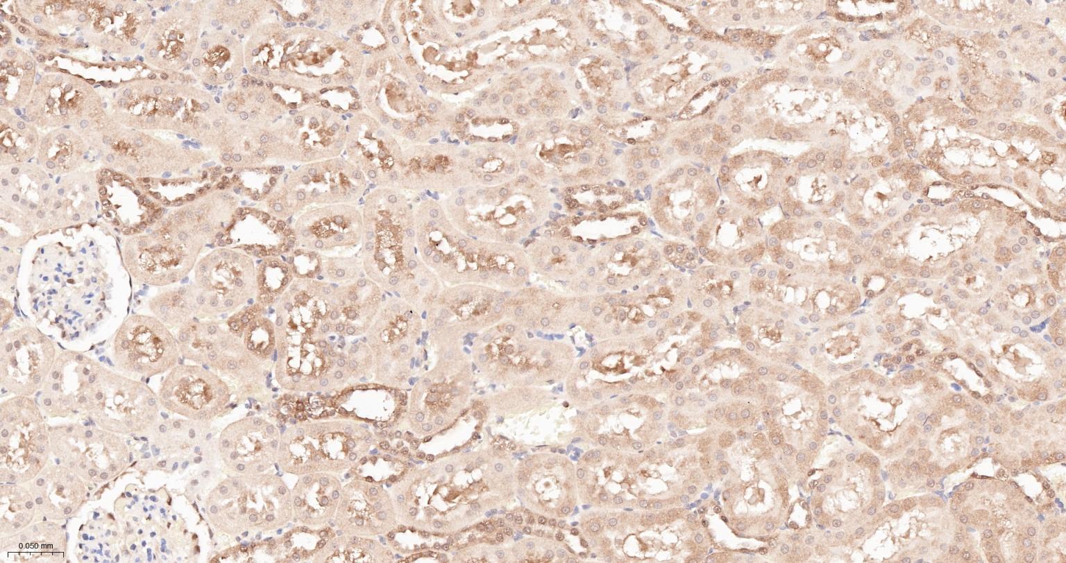 热休克蛋白90α重组兔单抗-bsm-52353R