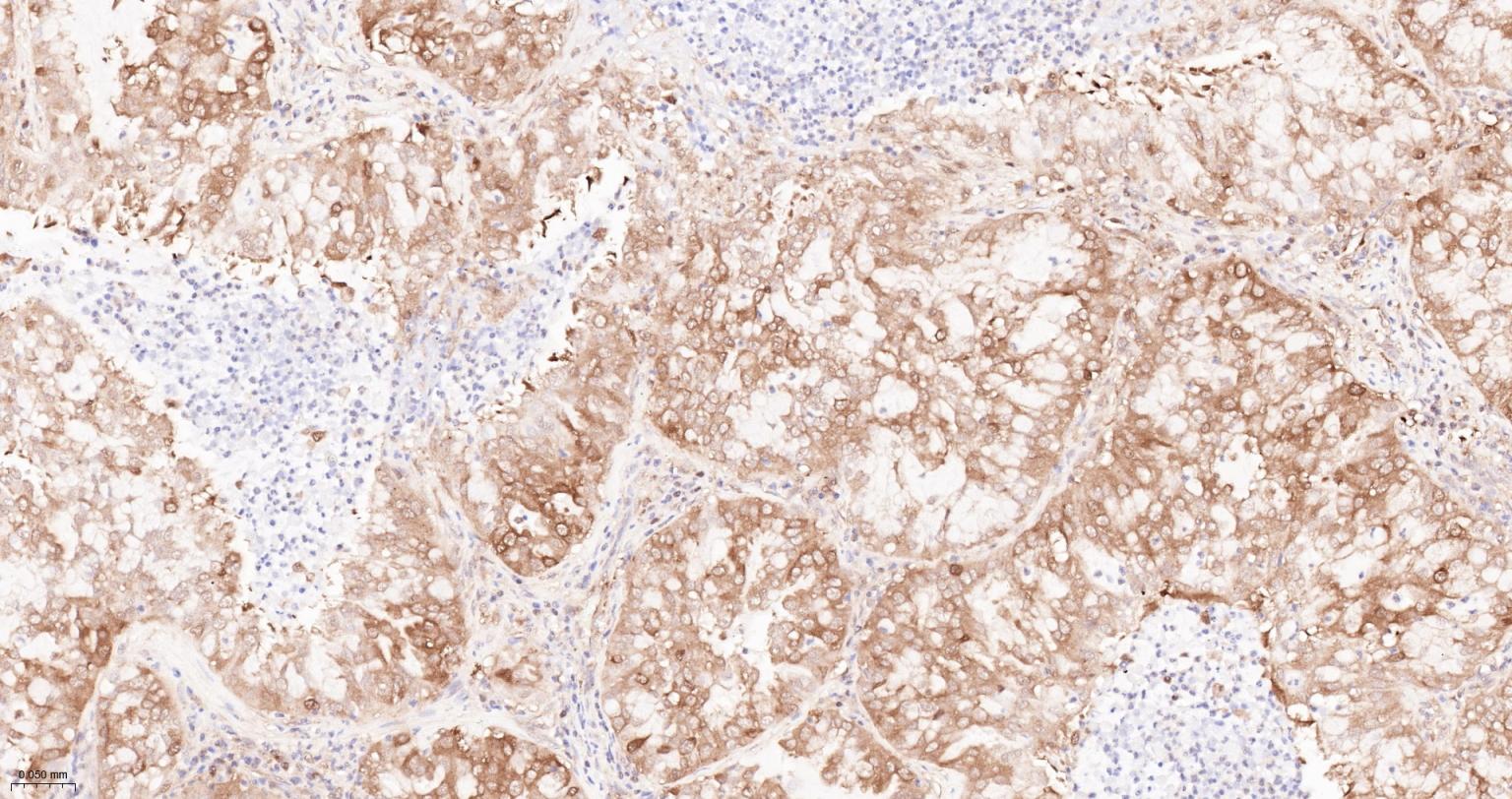 热休克蛋白90α重组兔单抗-bsm-52353R