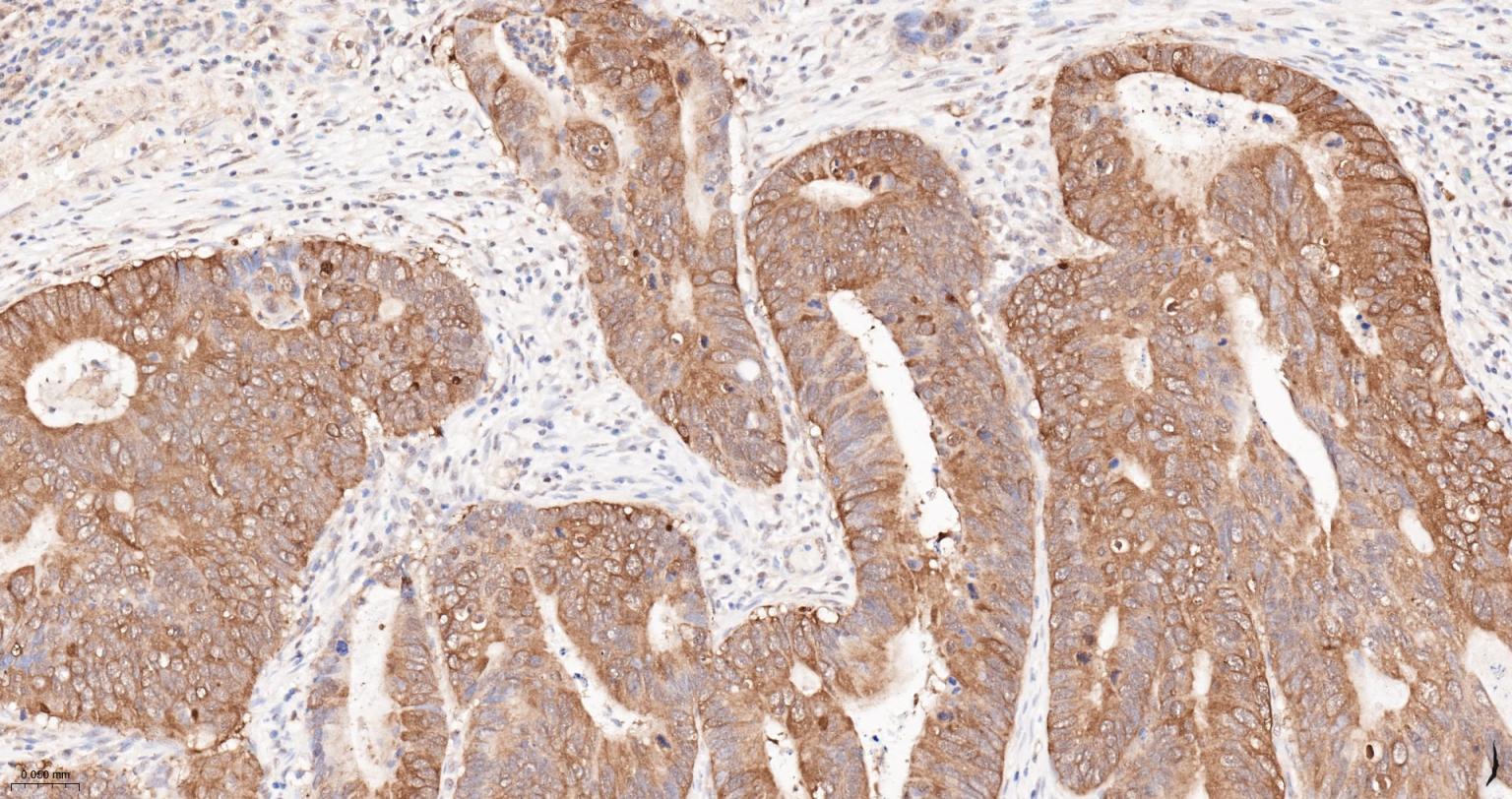 热休克蛋白90α重组兔单抗-bsm-52353R