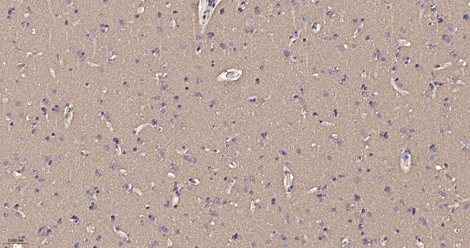 核突触蛋白-α重组兔单抗-bsm-54277R