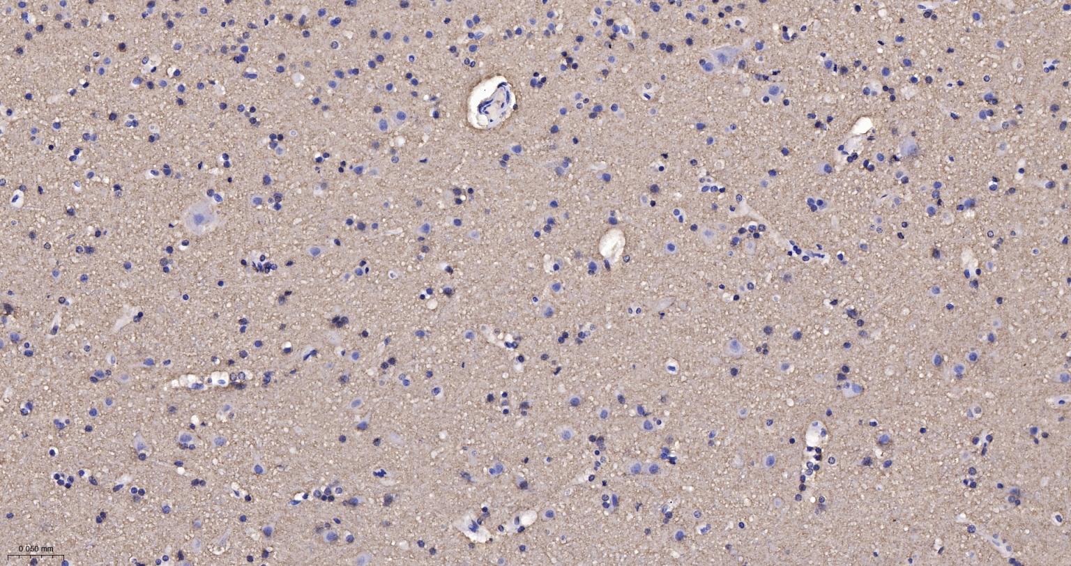 核突触蛋白-α重组兔单抗-bsm-54277R