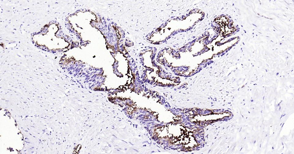 CD13重组兔单抗-bsm-60371R