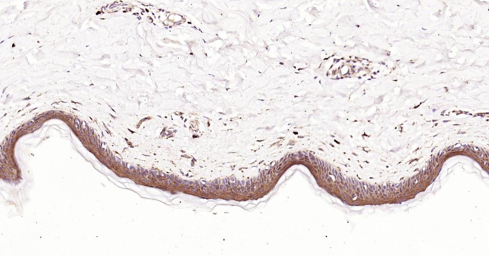 凋亡蛋白活性因子-1重组兔单抗-bsm-61152R