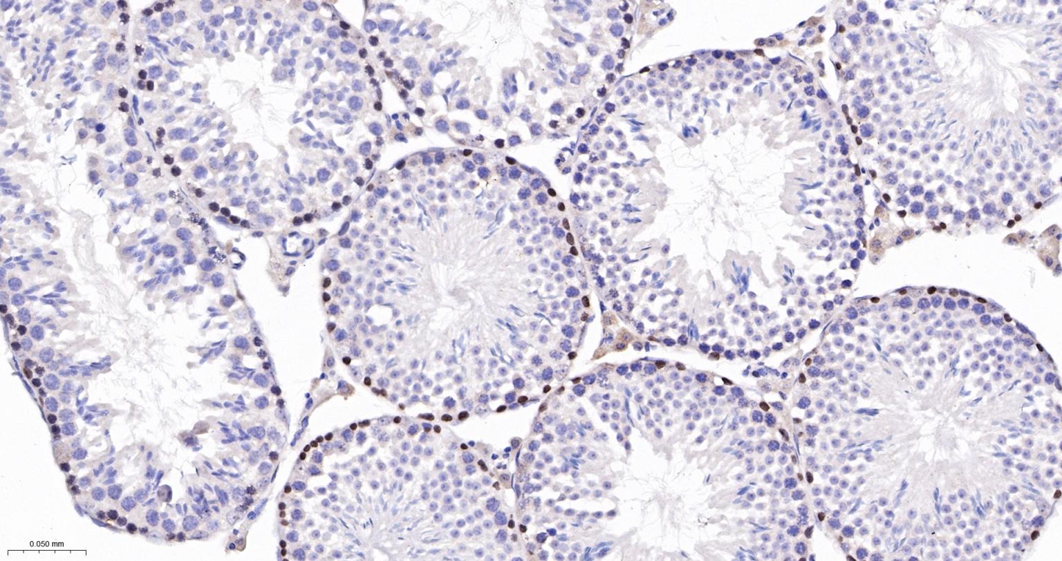 DNA甲基转移酶-3α重组兔单抗-bsm-61213R