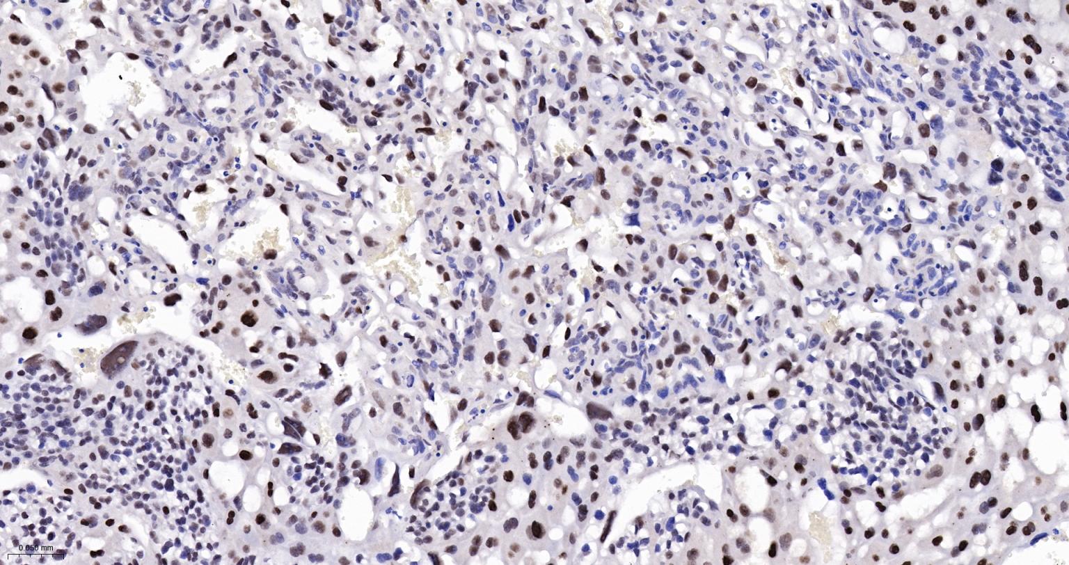 DNA甲基转移酶-3α重组兔单抗-bsm-61213R
