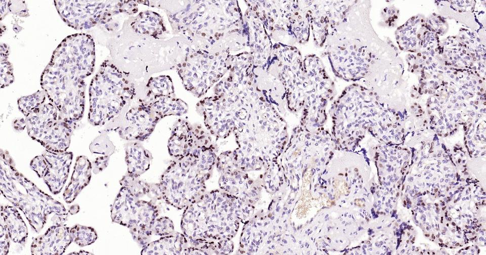DNA甲基转移酶-3α重组兔单抗-bsm-61213R
