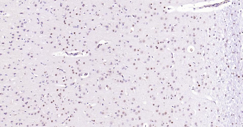 DNA甲基转移酶-3α重组兔单抗-bsm-61213R