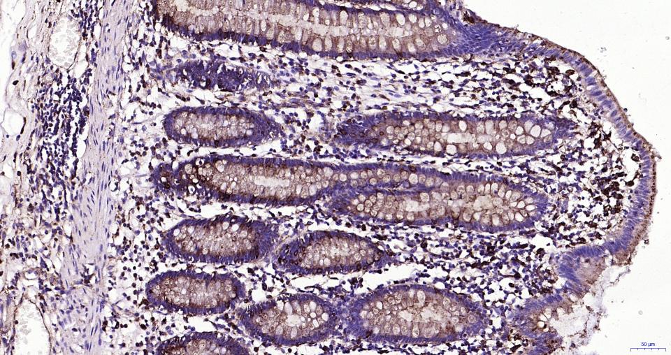 溶酶体相关膜蛋白1（CD107）重组兔单抗-bsm-61375R