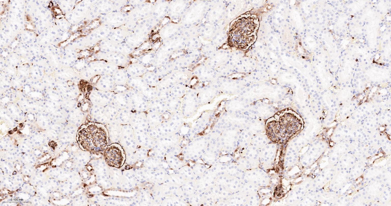 S100钙结合蛋白A6重组兔单抗-bsm-61393R