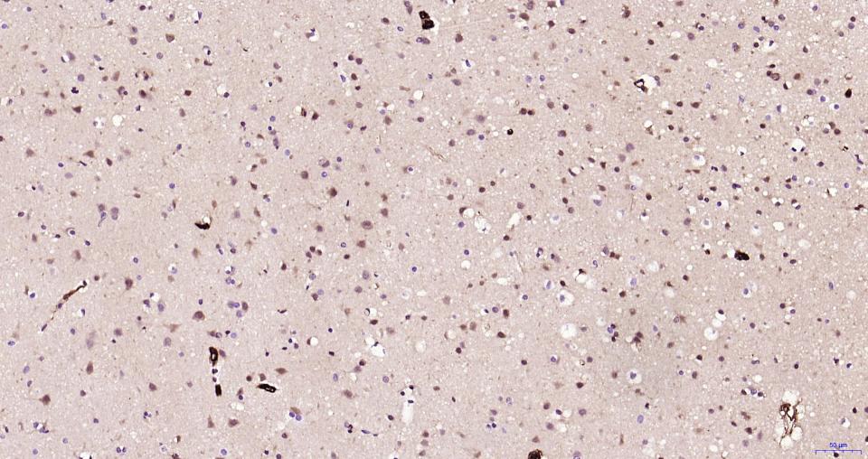 S100钙结合蛋白A6重组兔单抗-bsm-61393R