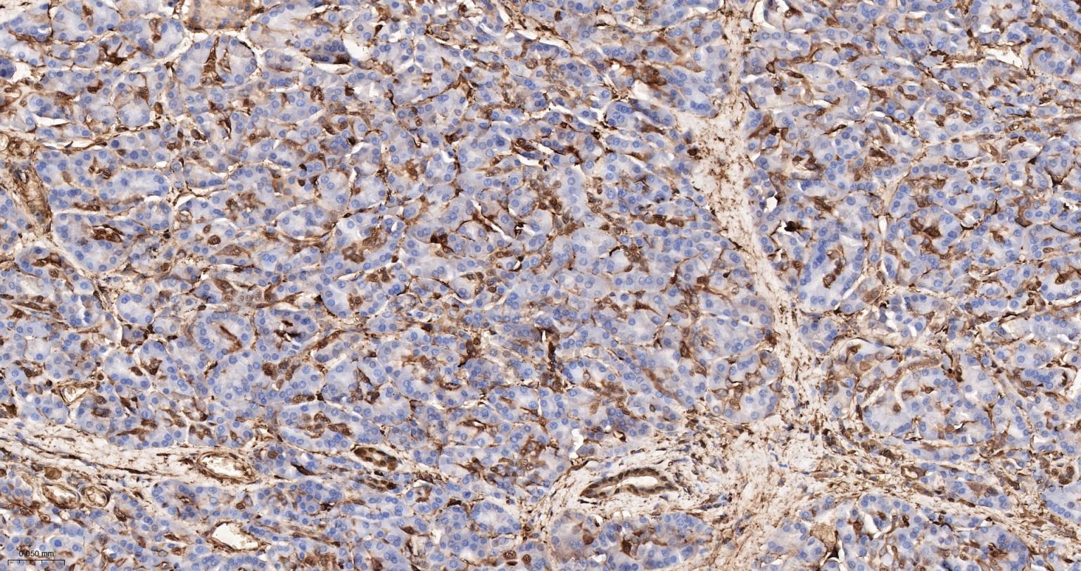 S100钙结合蛋白A6重组兔单抗-bsm-61393R