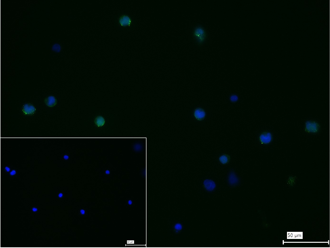 巨噬细胞甘露糖受体 (CD206) 重组兔单抗-bsm-60761R