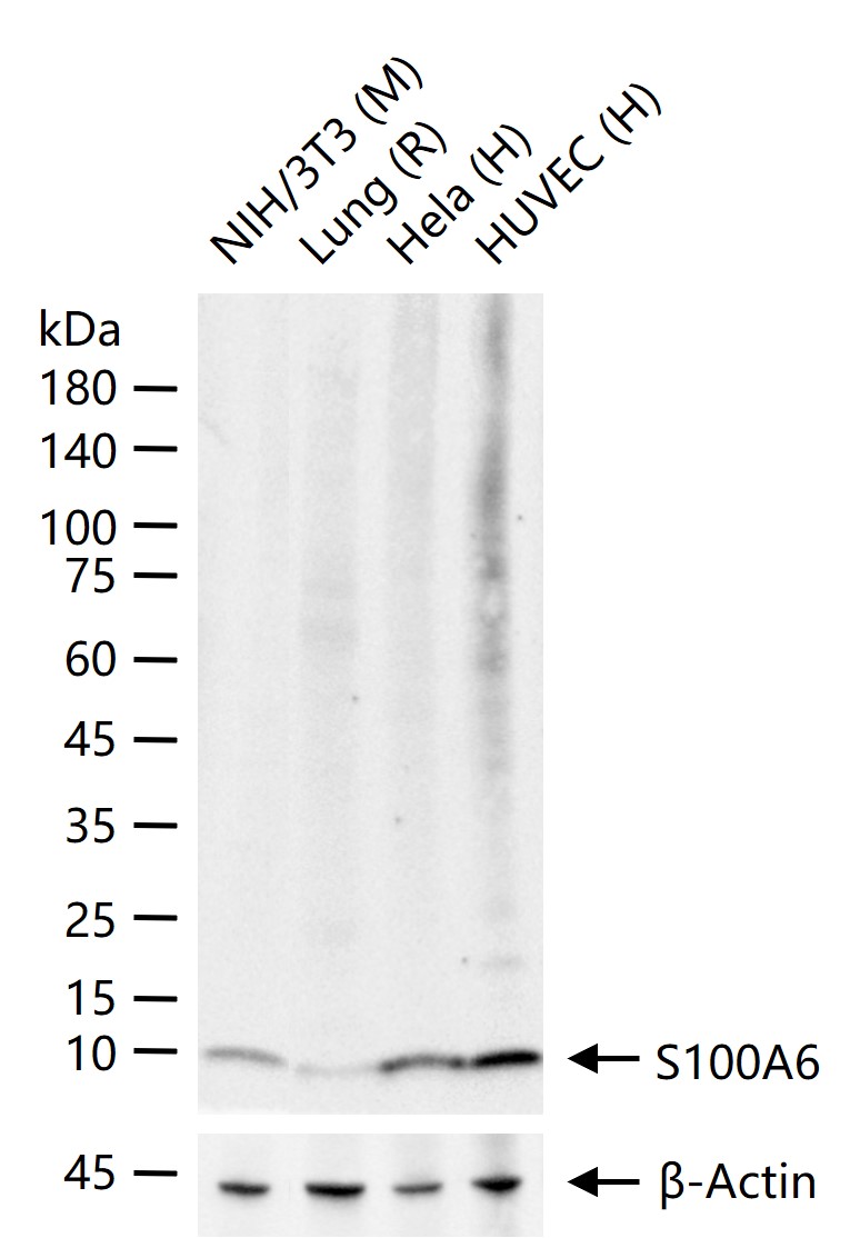 S100钙结合蛋白A6重组兔单抗-bsm-61393R
