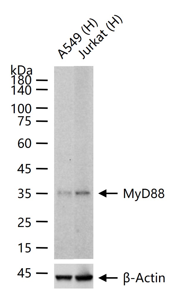髓样分化蛋白重组兔单抗-bsm-61269R