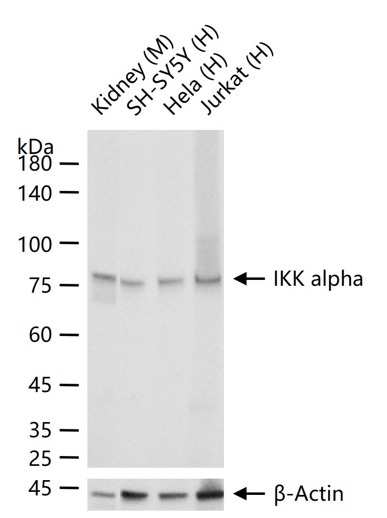 KB抑制蛋白激酶α重组兔单抗-bsm-61295R