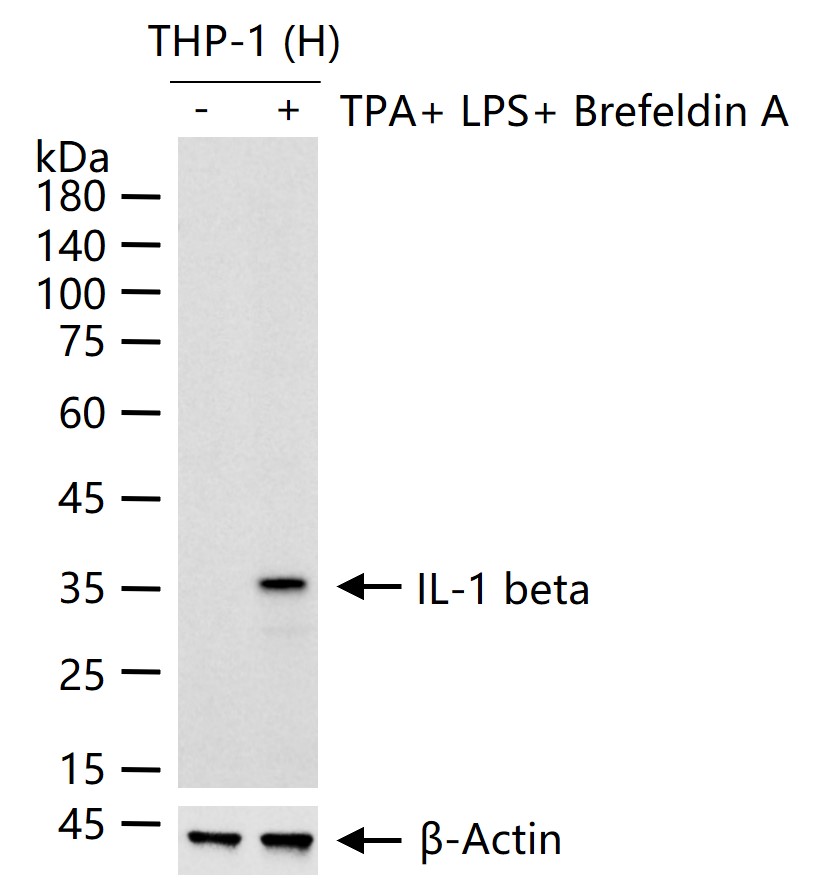 白介素1β/IL-1β重组兔单抗-bsm-52727R