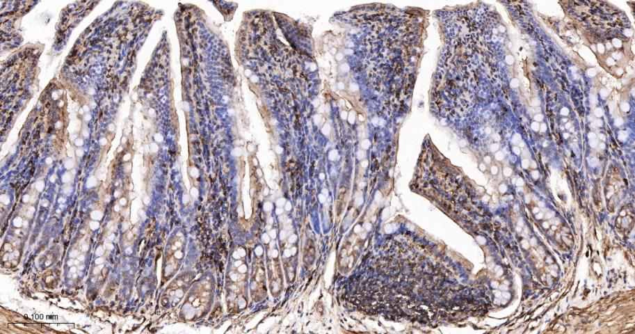 β-肌动蛋白/β-Actin（内参）抗体-bs-0061R