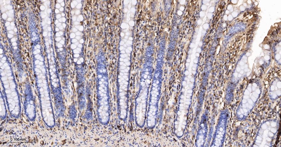 β-肌动蛋白/β-Actin（内参）抗体-bs-0061R