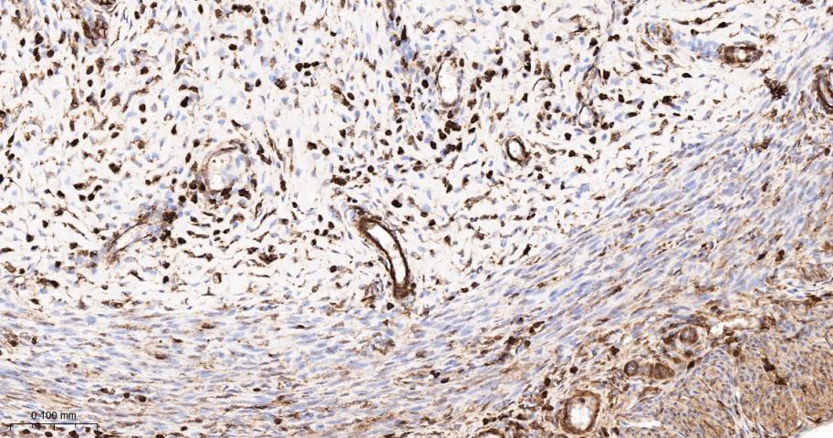 β-肌动蛋白/β-Actin（内参）抗体-bs-0061R