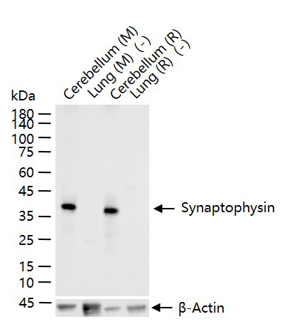 突触小泡蛋白P38重组兔单抗-bsm-52379R