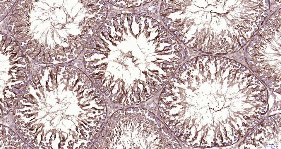 微管蛋白β tubulin/Tubulin β（内参）重组兔单抗-bsm-33034R