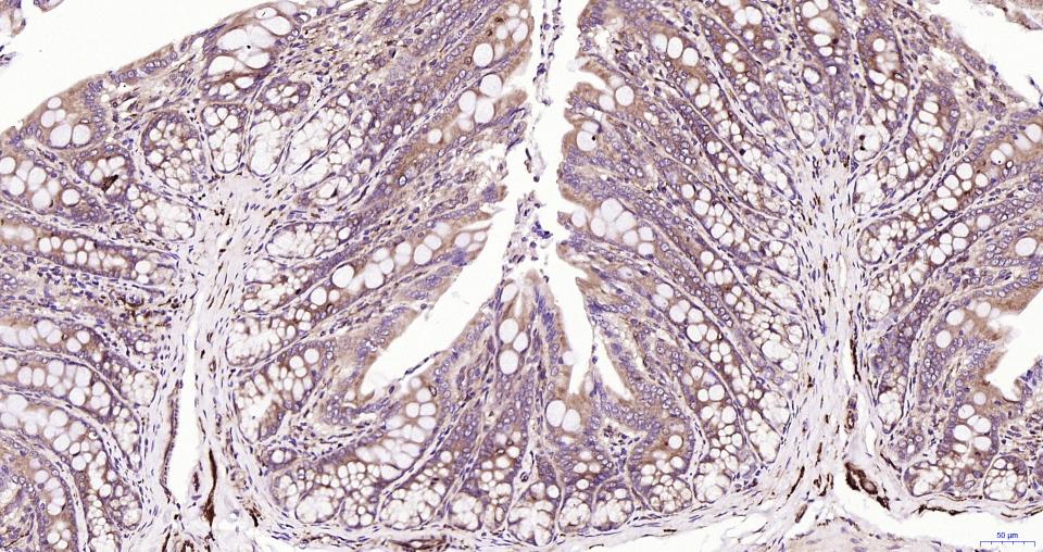 微管蛋白β tubulin/Tubulin β（内参）重组兔单抗-bsm-33034R