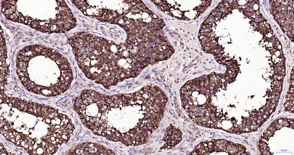 微管蛋白β tubulin/Tubulin β（内参）重组兔单抗-bsm-33034R