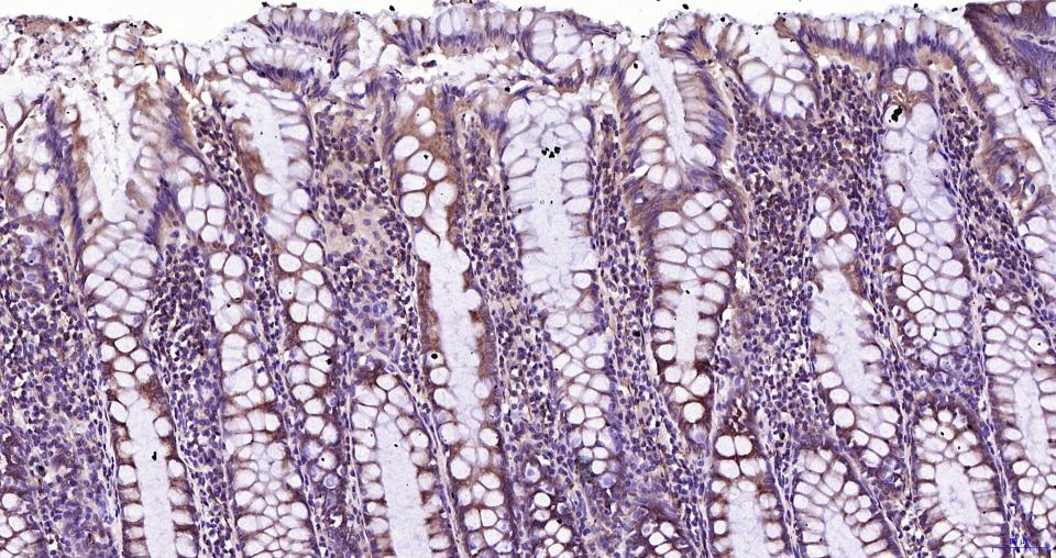 微管蛋白β tubulin/Tubulin β（内参）重组兔单抗-bsm-33034R