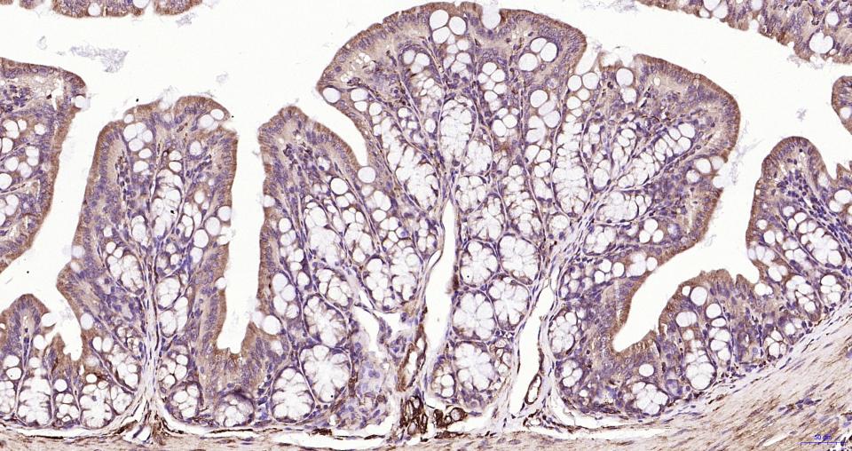 微管蛋白β tubulin/Tubulin β（内参）重组兔单抗-bsm-33034R