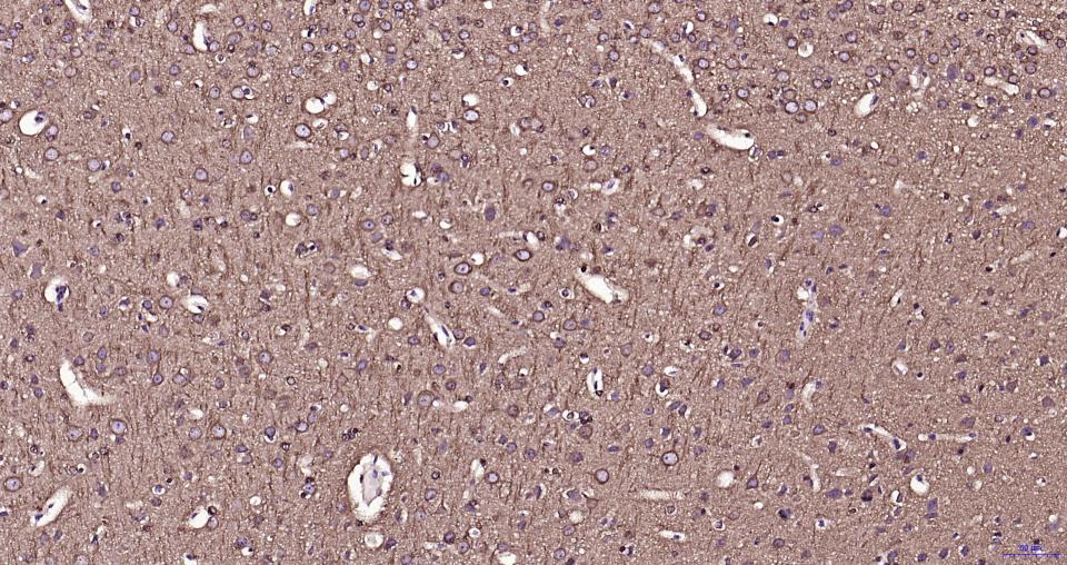 微管蛋白β tubulin/Tubulin β（内参）重组兔单抗-bsm-33034R