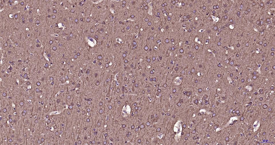 微管蛋白β tubulin/Tubulin β（内参）重组兔单抗-bsm-33034R
