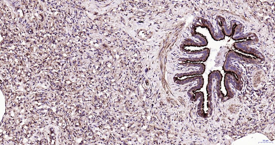 微管蛋白β tubulin/Tubulin β（内参）重组兔单抗-bsm-33034R