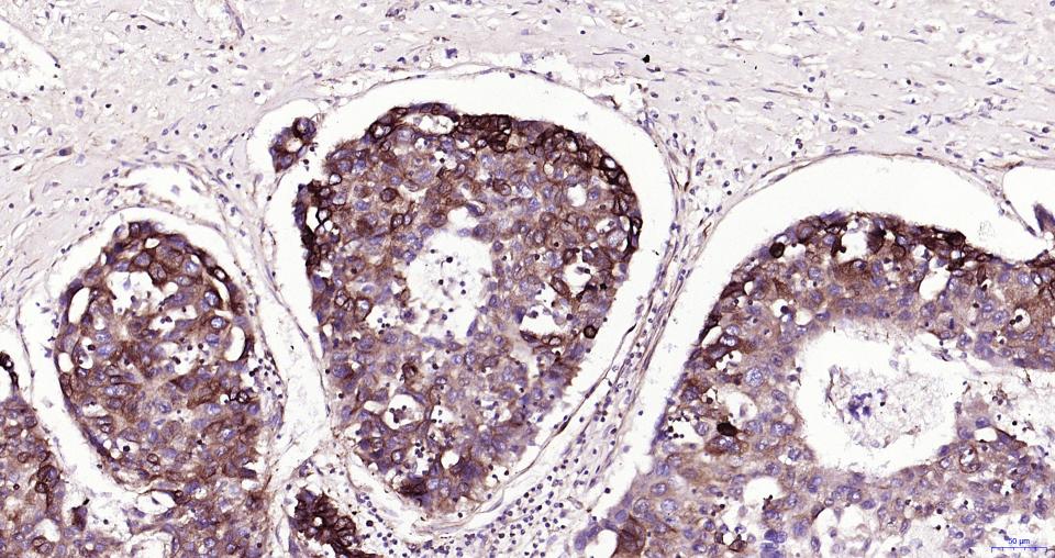 微管蛋白β tubulin/Tubulin β（内参）重组兔单抗-bsm-33034R