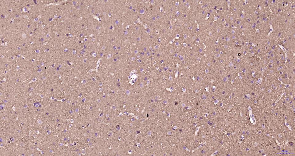 微管蛋白β tubulin/Tubulin β（内参）重组兔单抗-bsm-33034R
