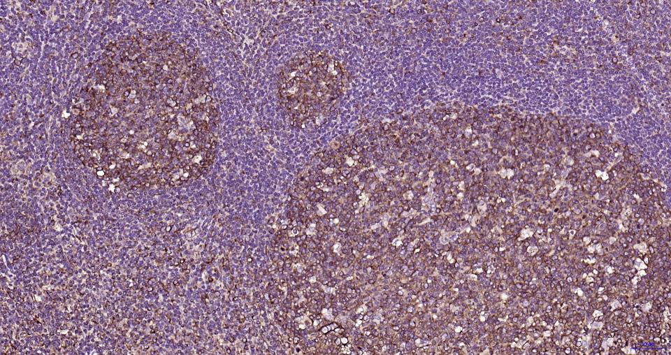 微管蛋白β tubulin/Tubulin β（内参）重组兔单抗-bsm-33034R