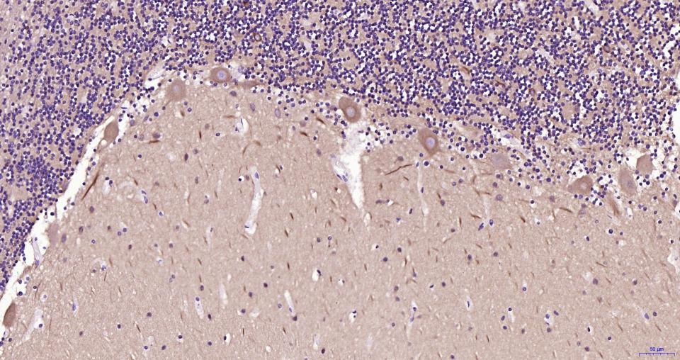 微管蛋白β tubulin/Tubulin β（内参）重组兔单抗-bsm-33034R
