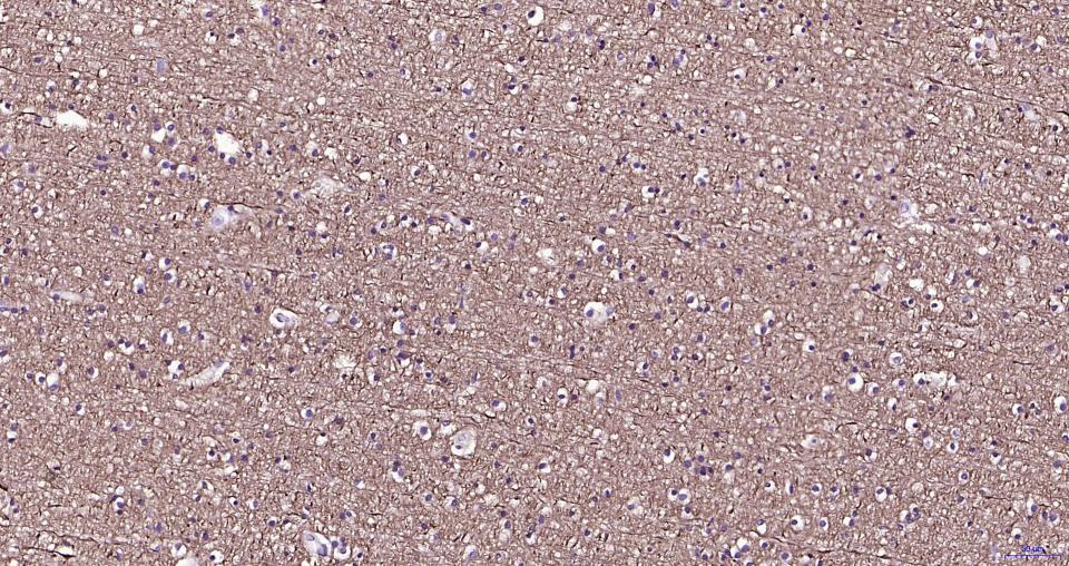 微管蛋白β tubulin/Tubulin β（内参）重组兔单抗-bsm-33034R