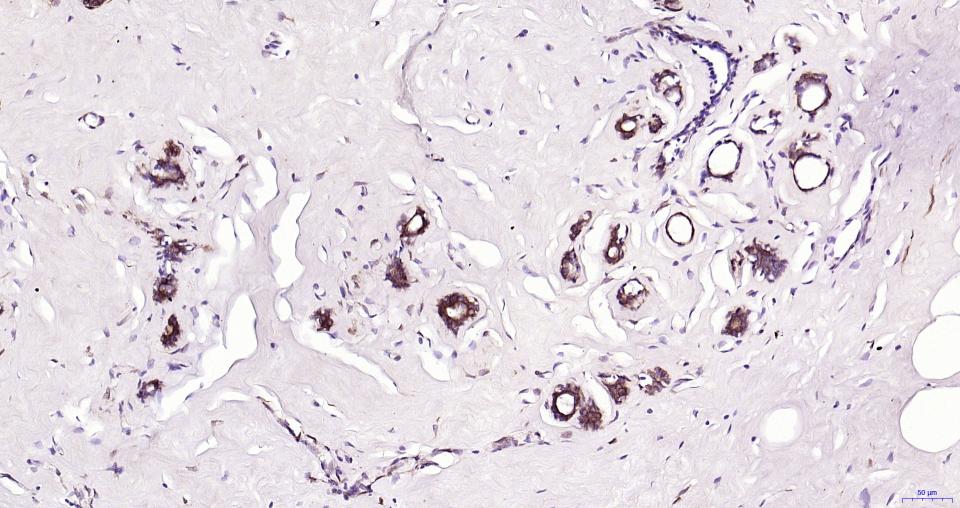 微管蛋白β tubulin/Tubulin β（内参）重组兔单抗-bsm-33034R