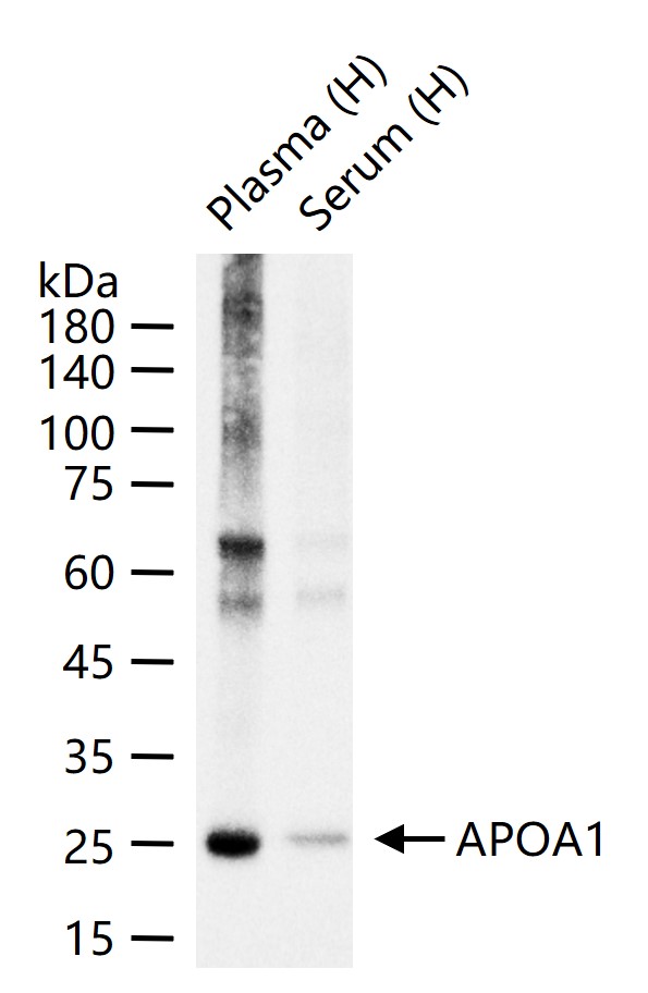 载脂蛋白A1重组兔单抗-bsm-61232R