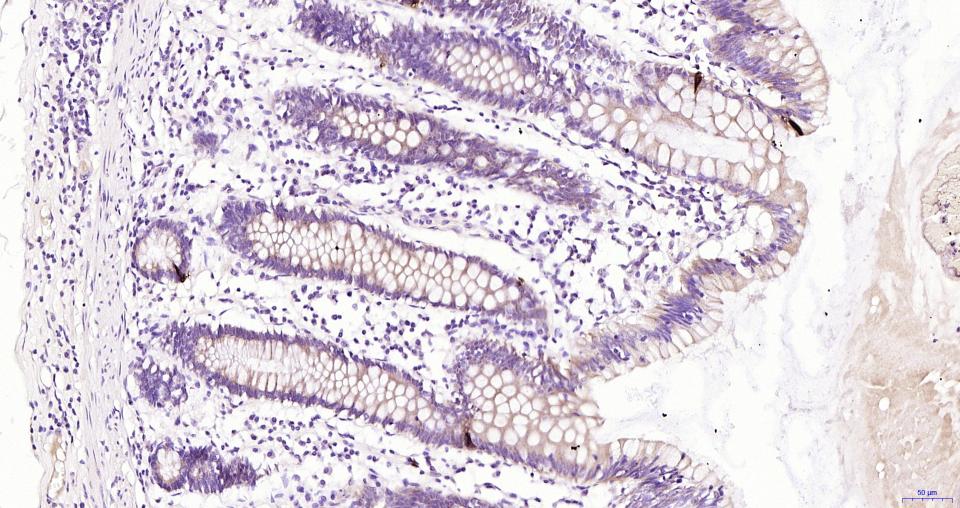 胰高血糖素重组兔单抗-bsm-62053R